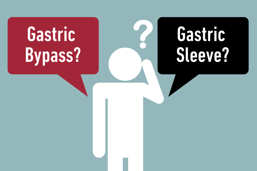 Gastric bypass vs gastric sleeve