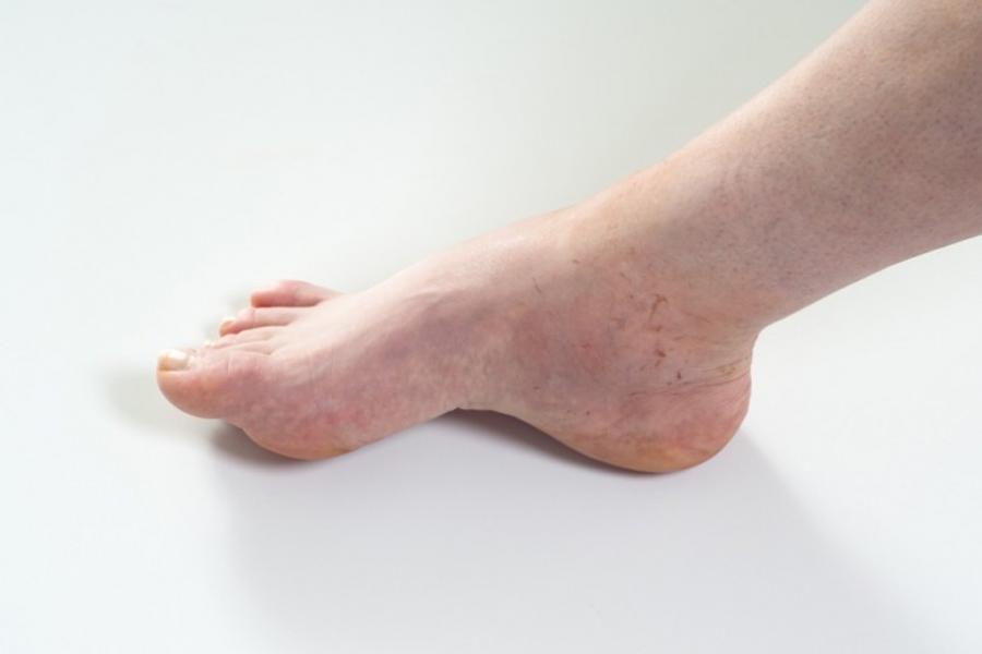 Closeup of persons foot