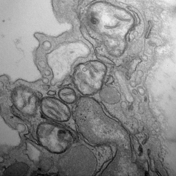 Endothelial mitochondria in mouse aorta