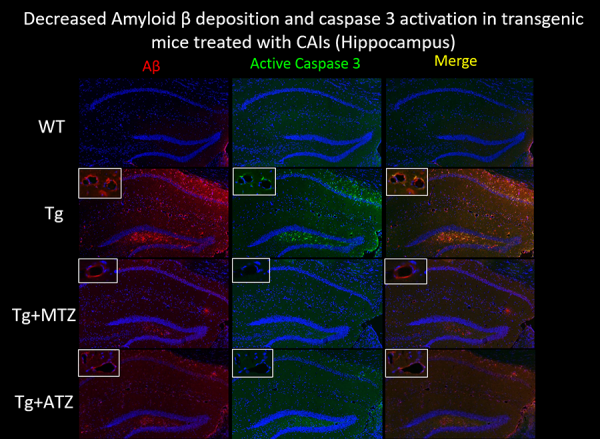 Presence of Amyloid beta (Aβ) deposits (Red) in the hippocampus